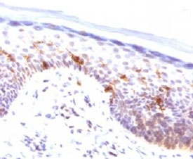 IHC testing of FFPE human skin stained with CD1a antibody (clone CLDA1a). Staining of formalin-fixed tissues requires boiling tissue sections in pH 9 10mM Tris with 1mM EDTA for 10-20 min followed by cooling at RT for 20 min.