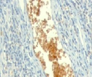 Formalin-fixed, paraffin-embedded human tonsil stained with AMPD3 antibody (clone ETAD3-1).