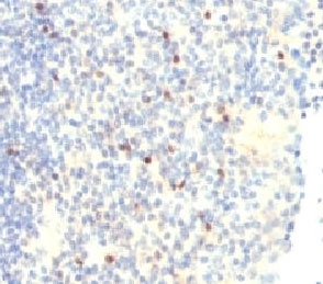 IHC analysis of FOXP3 antibody (clone FHBP3-1) and human tonsil tissue. Required HIER: boil tissue sections in 10mM Tris buffer with 1mM EDTA, pH 9, for 10-20 min.