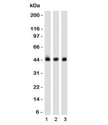 Western blot of 1) K562, 2) 293 and 3) A549 cell lysates using Napsin A antibody (clone NPSNA-1). Expected molecular weight: 38-45 kDa depending on glycosylation level.