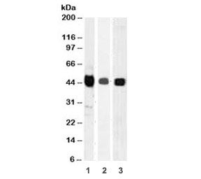 Western blot testing of A) HepG2, B) PC3 and C) HeLa cell lysate wiht TIA-1 antibody (clone TRIA1-1). The long and short forms differ by 17 amino acids. Predicted molecular weight: ~43kDa and ~15kDa (granulocyte-associated isoform).