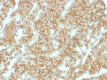 IHC testing of FFPE human parathyroid gland stained with recombinant PTH antibody (clone PTH/1717R). Required HIER: steam sections in 10mM citrate buffer, pH 6.0, for 10-20 min.
