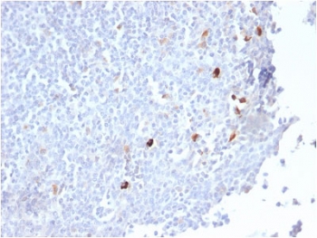 IHC staining of FFPE human tonsil tissue with recombinant IgM antibody (clone IGHM/2559R). HIER: boil tissue sections in pH 9 10mM Tris with 1mM EDTA for 10-20 min and allow to cool before testing.