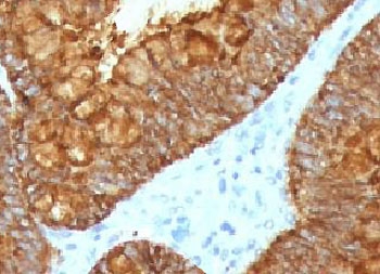 IHC testing of FFPE human colon tissue with recombinant AURKB antibody (clone ARRK2-2R). HIER: boil tissue sections in pH6, 10mM citrate buffer, for 10-20 min followed by cooling at RT for 20 min.