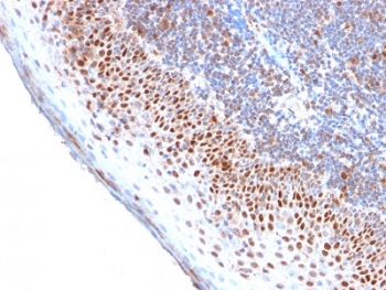 IHC testing of FFPE human tonsil with recombinant MCM7 antibody. Required HIER: boil tissue sections in pH 9 10mM Tris with 1mM EDTA for 10-20 min.