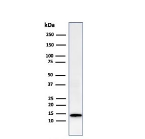 Western blot testing of human HeLa cell lysate with recombinant Galectin 1 antibody (clone GAL1/2499R). Expected molecular weight ~14 kDa.