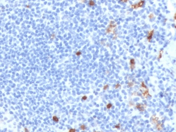 IHC staining of FFPE human tonsil tissue with recombinant IgM antibody (clone MuHC2-2R). HIER: boil tissue sections in pH 9 10mM Tris with 1mM EDTA for 10-20 min and allow to cool before testing.