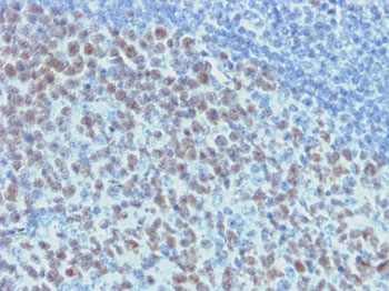 IHC testing of FFPE human tonsil with recombinant Bcl6 antibody (clone ARBC6-2R). Required HIER: boil tissue sections in 10mM citrate buffer, pH 6, for 10-20 min.