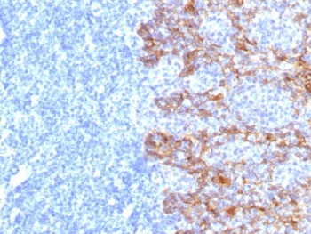 IHC staining of FFPE human tonsil tissue with Acidic Cytokeratin antibody (clone SPM115). HIER: boil tissue sections in pH 9 10mM Tris with 1mM EDTA for 10-20 min and allow to cool before testing.