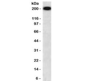 Western blot testing of human brain lysate with recombinant NF-H antibody (clone NFHP-1R). Expected molecular weight ~200 kDa.