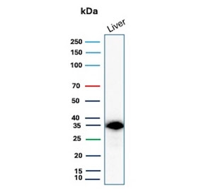 Western blot testing of human liver lysate with SULT1E1 antibody (clone CPTC-SULT1E1-1). Expected molecular weight ~33-35 kDa.
