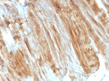 IHC staining of FFPE skeletal muscle with Dystrophin antibody (clone DMD/3243). HIER: boil tissue sections in pH6, 10mM citrate buffer, for 10-20 min and allow to cool before testing.