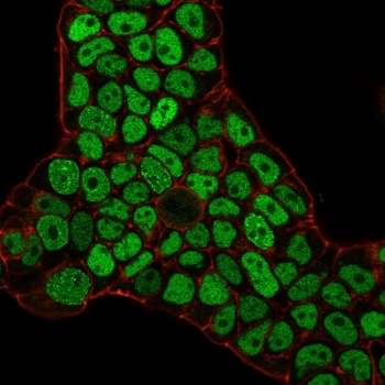 Immunofluorescence staining of PFA-fixed human MCF-7 cells with MSH6 antibody (green, clone MSH6/3086) and Phalloidin (red).