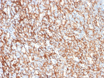 IHC staining of FFPE human tonsil tissue with CD73 antibody (clone NT5E/2505). HIER: boil tissue sections in pH9 10mM Tris with 1mM EDTA for 10-20 min and allow to cool before testing.