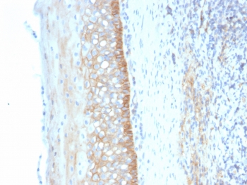 IHC staining of FFPE human tonsil tissue with CD73 antibody (clone NT5E/2545). HIER: boil tissue sections in pH9 10mM Tris with 1mM EDTA for 10-20 min and allow to cool before testing.