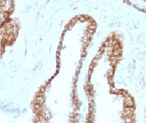 Ck5 CK5 Antibody | Cytokeratin 5 | CTKN5-1 | V7589 NSJ Bioreagents