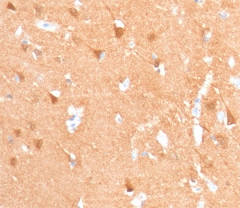 IHC staining of FFPE human cerebellum with recombinant UchL1 antibody (clone rUBCE-L1). Required HIER: boil tissue sections in pH 9 10mM Tris with 1mM EDTA for 10-20 min followed by cooling at RT for 20 min.