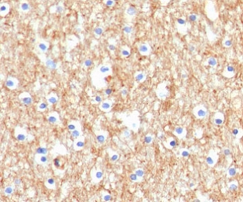 IHC staining of FFPE human brain with Drebrin 1 antibody (clone DRBP1-1). HIER: boil tissue sections in pH 9 10mM Tris with 1mM EDTA for 10-20 min followed by cooling at RT for 20 min.