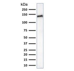 Western blot testing of human small intestine lysate with Cadherin 17 antibody (clone CDH17/2617). Expected molecular weight ~120 kDa.