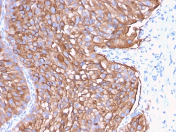 IHC staining of FFPE human urinary bladder with UPK1A antibody (clone UPK1A/2922). HIER: boil tissue sections in pH 9 10mM Tris with 1mM EDTA for 10-20 min and allow to cool before testing.