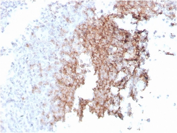 IHC staining of FFPE human spleen with recombinant CD21 antibody (clone rCR2/1952). HIER: boil tissue sections in pH 9 10mM Tris with 1mM EDTA for 10-20 min and allow to cool before testing.