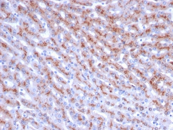 IHC staining of FFPE human liver with Cathepsin D antibody (clone CTSD/3083). HIER: boil tissue sections in pH 9 10mM Tris with 1mM EDTA for 10-20 min and allow to cool before testing.