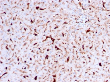 IHC staining of FFPE human liver with Cathepsin K antibody (clone CTSK/2792). HIER: boil tissue sections in pH 9 10mM Tris with 1mM EDTA for 10-20 min and allow to cool before testing.