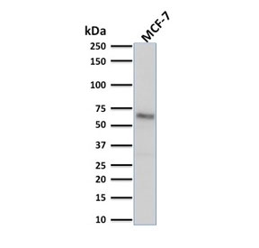 Western blot testing of human MCF7 cell lysate with Estrogen Receptor alpha antibody (clone ESR1/1904). Predicted molecular weight ~66 kDa.