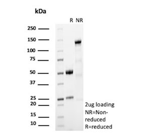 SDS-PAGE analysis of purified, BSA-free FOLH1 antibody (clone FOLH1/2494) as confirmation of integrity and purity.