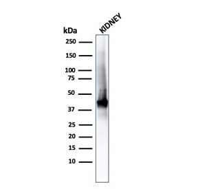 Western blot testing of human kidney lysate with recombinant AMACR/p504S antibody (clone rAMACR/1864). Predicted molecular weight ~43 kDa.