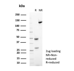 SDS-PAGE analysis of purified, BSA-free Alkaline Phosphatase antibody (clone SPM372) as confirmation of integrity and purity.
