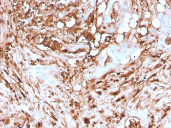 IHC staining of FFPE human pancreas with recombinant FTL antibody (clone rFTL/1388). HIER: boil tissue sections in pH 9 10mM Tris with 1mM EDTA for 10-20 min and allow to cool before testing.