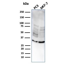 Western blot testing of human PC-3 and MCF-7 cell lysate with NKX2.8 antibody. Predicted molecular weight ~26 kDa, commonly observed at 26-34 kDa.