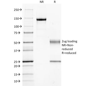 SDS-PAGE analysis of purified, BSA-free GNAQ antibody as confirmation of integrity and purity.