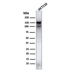 Western blot testing of human HCT116 lysate with MSH6 antibody (clone MSH6/3089). Expected molecular weight: 120-160 kDa depending on phosphorylation level.