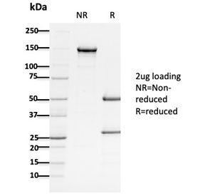 SDS-PAGE analysis of purified, BSA-free Adenomatous polyposis coli antibody (clone ALi 12-28) as confirmation of integrity and purity.
