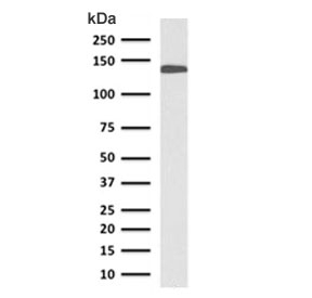 Western blot testing of human small intestine lysate with Cadherin 17 antibody (clone CDN17-1). Predicted molecular weight ~92 kDa but may be observed at higher molecular weights due to glycosylation.