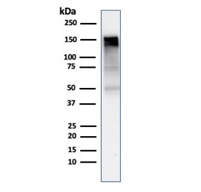 Western blot testing of human A431 cell lysate with EGFR antibody (clone rGFR/1667). Expected molecular weight: ~134/170 kDa (unmodified/glycosylated).