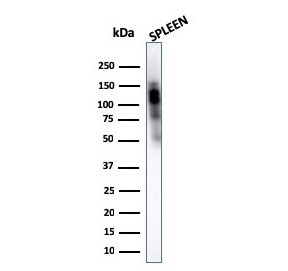 Western blot testing of human spleen lysate with CD11b antibody (clone ITGAM/3340). Expected molecular weight: 127~170 kDa depending on glycosylation level.