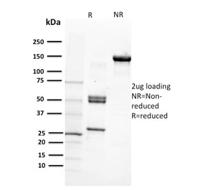 SDS-PAGE analysis of purified, BSA-free CD29 antibody (clone 12G10) as confirmation of integrity and purity.