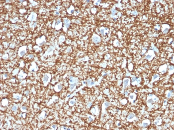 IHC staining of FFPE human brain with ARF1 antibody (clone ARF1/2117). HIER: boil tissue sections in pH 9 10mM Tris with 1mM EDTA for 20 min and allow to cool before testing.