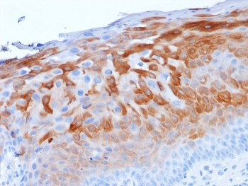 IHC staining of FFPE human cervix with Cytokeratin 1 antibody (clone LHK1). HIER: boil tissue sections in pH 9 10mM Tris with 1mM EDTA for 20 min and allow to cool before testing.