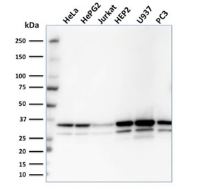 Western blot testing of human samples with MDH1 antibody (clone CPTC-MDH1-1). Predicted molecular weight: ~36 kDa.