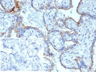 IHC staining of FFPE human placenta with MMP3 antibody. HIER: boil tissue sections in pH 9 10mM Tris with 1mM EDTA for 20 min and allow to cool before testing. Negative control inset: PBS used instead of primary antibody to control for secondary Ab binding.