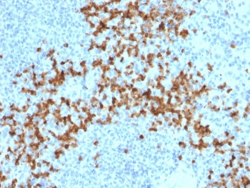 IHC staining of FFPE human spleen with Matrix metalloproteinase 9 antibody (clone 2C3). HIER: boil tissue sections in pH 9 10mM Tris with 1mM EDTA for 20 min and allow to cool before testing.