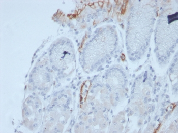 IHC staining of FFPE human stomach with recombinant MUC2 antibody (clone rMLP/842). HIER: boil tissue sections in pH 9 10mM Tris with 1mM EDTA for 20 min and allow to cool before testing.