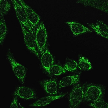 Immunofluorescent staining of PFA-fixed human HeLa cells with recombinant Cytochrome C antibody (clone CYCS/3128R, green).