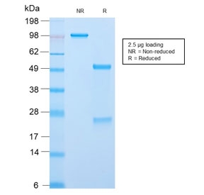 SDS-PAGE analysis of purified, BSA-free recombinant CLIP antibody (clone CLIP/2859R) as confirmation of integrity and purity.