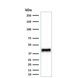 Western blot testing of mouse NIH3T3 cell lysate with BMI1 antibody (clone BMI1/2823). Predicted molecular weight: 37-43 kDa.