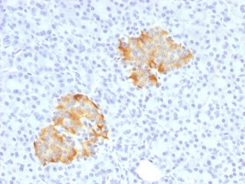IHC staining of FFPE human pancreas with TNF alpha antibody. HIER: boil tissue sections in pH 9 10mM Tris with 1mM EDTA for 20 min and allow to cool before testing.